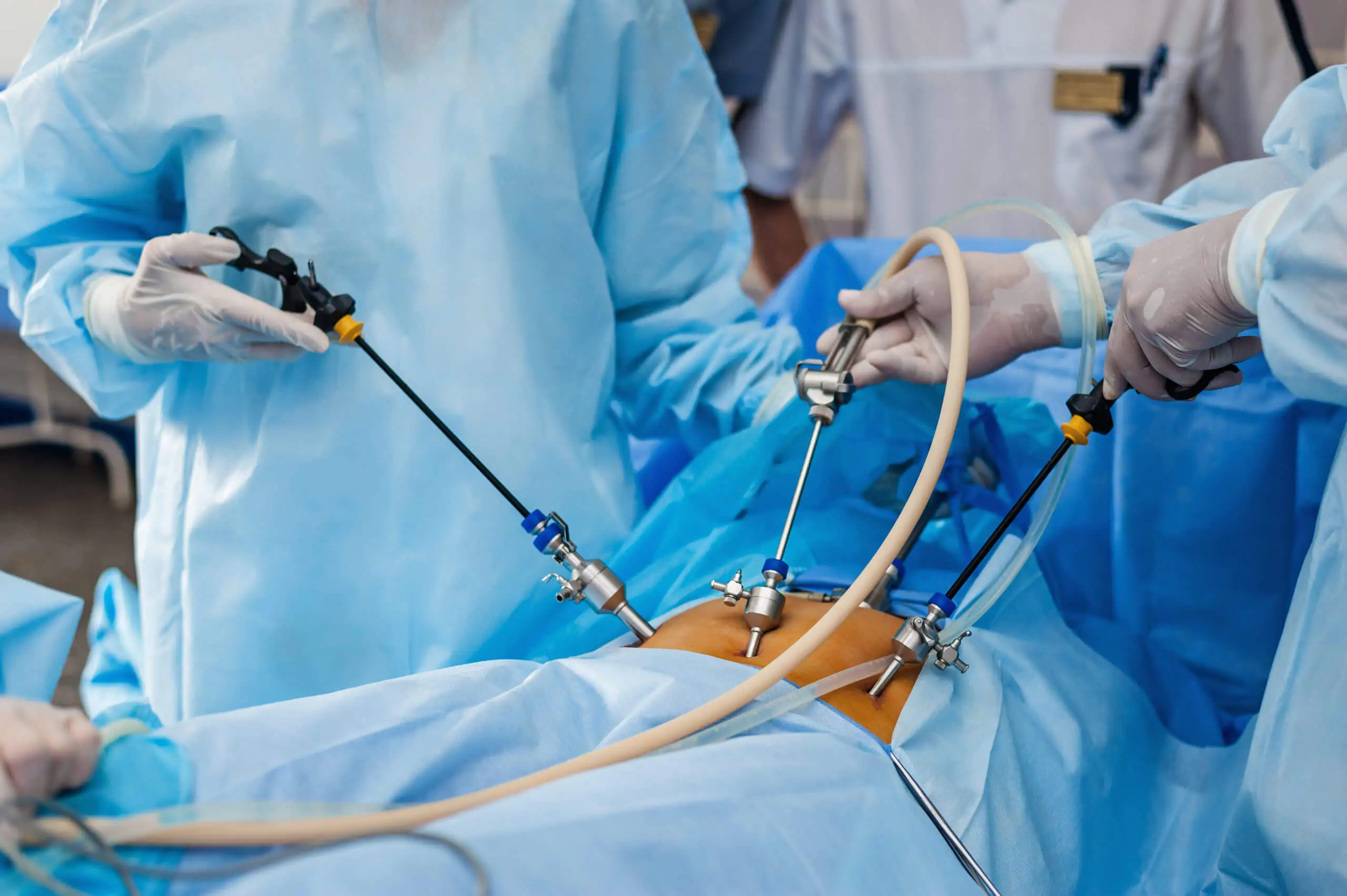 Laparoscopic Surgery 2