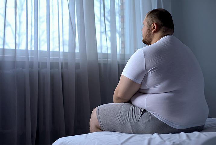 Obesity Photo