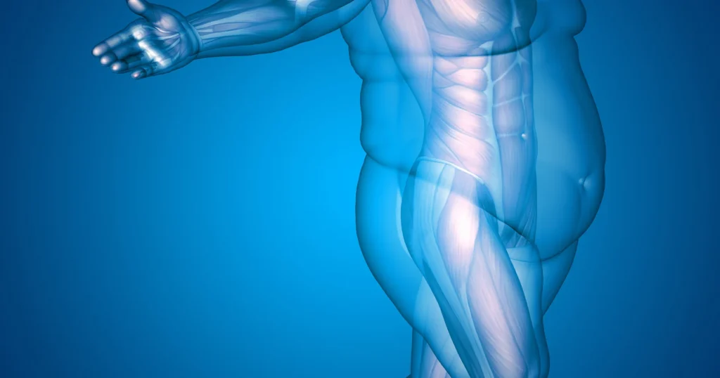 Break Free from Obesity, Embrace a Healthier You!