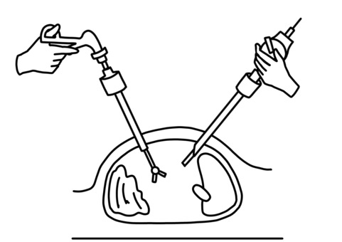 Laparoscope