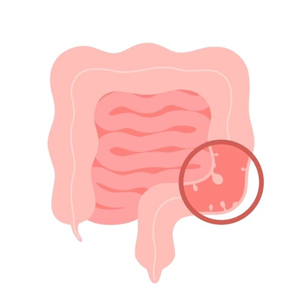 Gastrointestinal issues