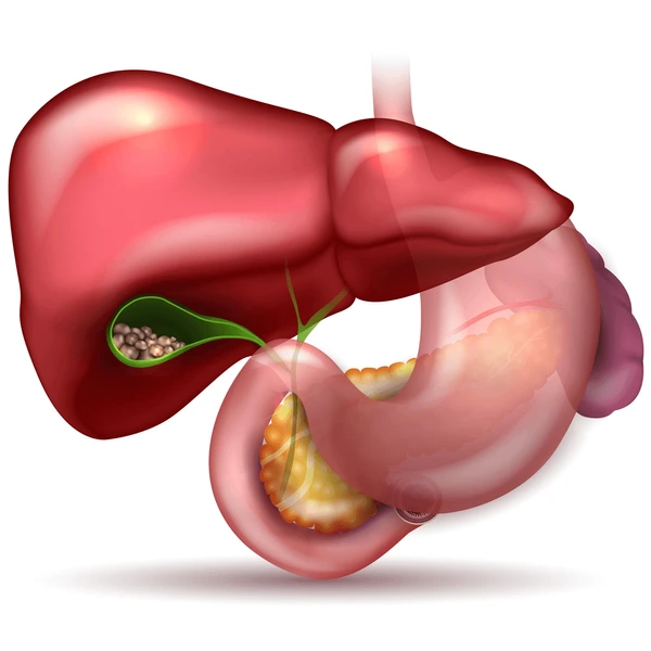 Complicated Gallbladder Conditions