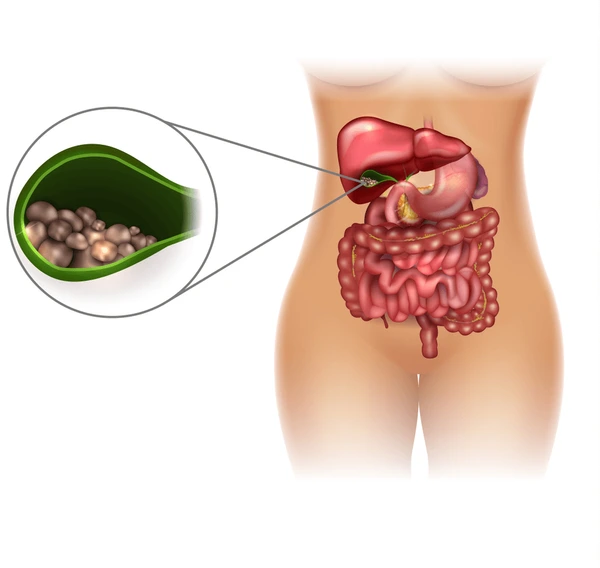 Abdominal Conditions
